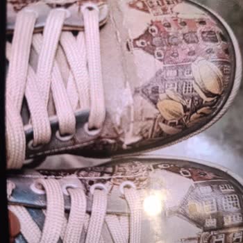 Az Kullanılan Ayakkabının Deri Soyulması Ve Mağazanın Yardım Reddetmesi