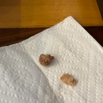 Eskişehir Ciğerci Bahattin Şubesinde Yabancı Cisim Ve Yetersiz Açıklama Şikayeti