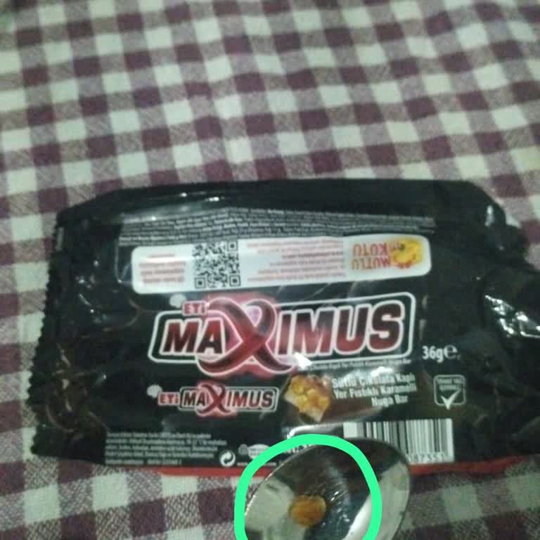 Eti Maximus Yüzünden Dolgulu Dişim Ciddi Şekilde Zarar Gördü