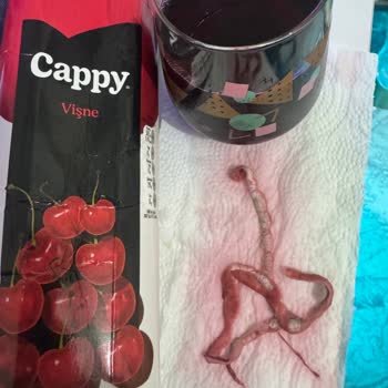 Cappy Vişne Suyunda Yabancı Madde Çıktı Sağlık Ve Hijyen Endişesi