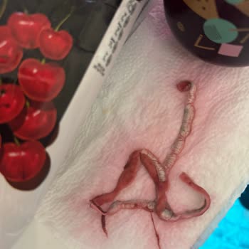 Cappy Vişne Suyunda Yabancı Madde Çıktı Sağlık Ve Hijyen Endişesi