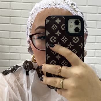 Ombre İşleminde Yanma, Saç Dökülmesi Ve 31 Bin TL Ücret İadesi Talebi