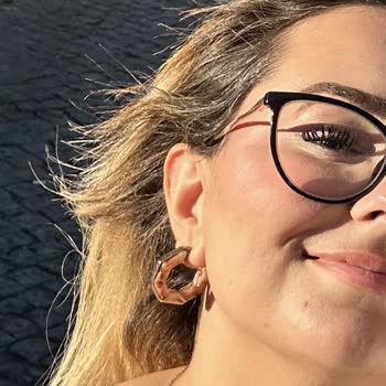 Ombre İşleminde Yanma, Saç Dökülmesi Ve 31 Bin TL Ücret İadesi Talebi