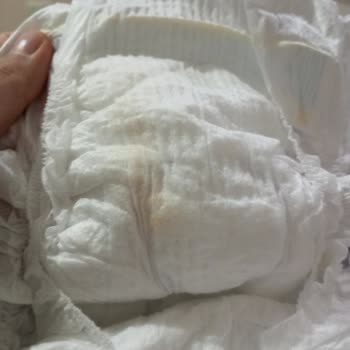 Molfix Bebek Bezinde Belirlenemeyen Leke Güveni Sarsıyor