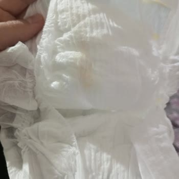 Molfix Bebek Bezinde Belirlenemeyen Leke Güveni Sarsıyor