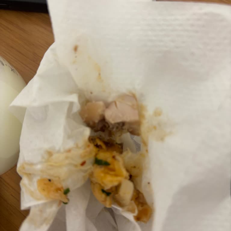 Yemeksepeti Siparişinde Kemik Parçası, Sağlık Riski Ve İlgisizlik