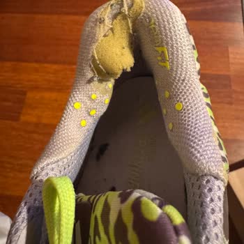 Adidas Dropset 3 Ayakkabısında Hızlı Bilek Soyulması Ve Reddedilen Değişim Talebi