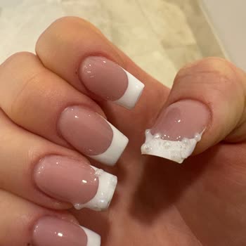 Özlem Öz Beauty Center Tırnaklarım Yandı, Etlerim Yara Oldu Ve Ciddi Acı Hissettim