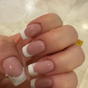 Özlem Öz Beauty Center Tırnaklarım Yandı, Etlerim Yara Oldu Ve Ciddi Acı Hissettim