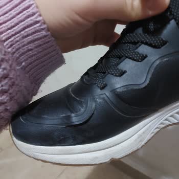 Skechers Ayakkabısının Bağlama Noktalarının Erken Kopması Ve Değişim Reddi