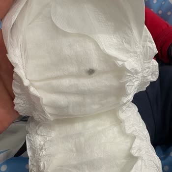 Sleepy Bebek Bezinde Sert Taş Benzeri Yabancı Madde Ve Güvenlik Endişesi