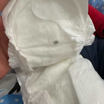 Sleepy Bebek Bezinde Sert Taş Benzeri Yabancı Madde Ve Güvenlik Endişesi