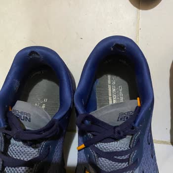 Skechers Sneakers Kalitesizliği!