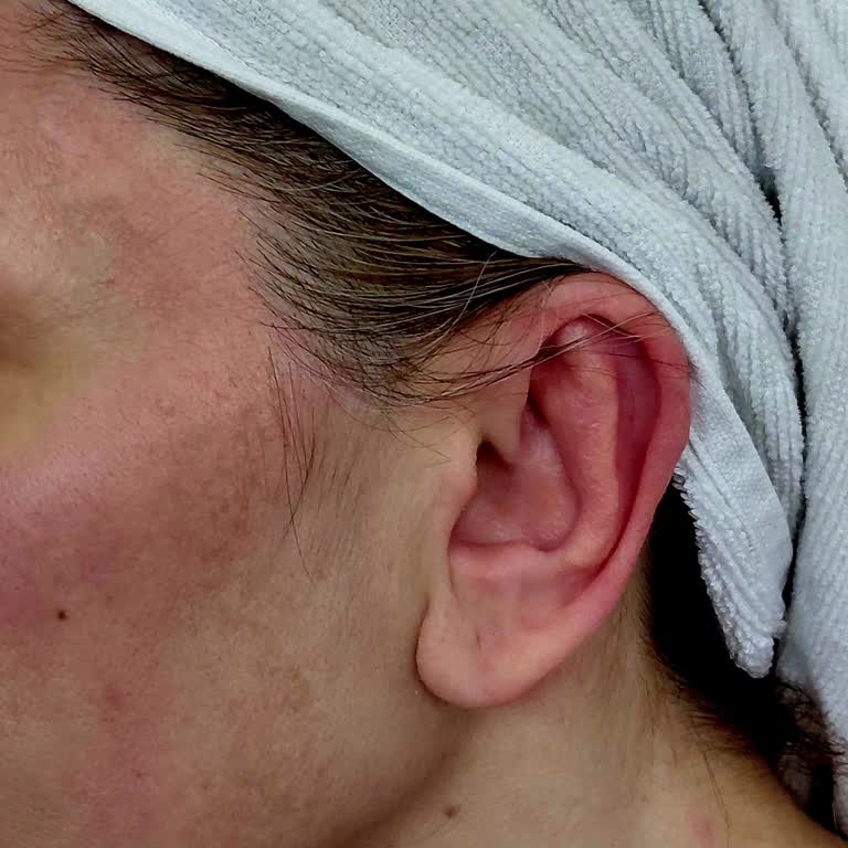 Sebamed Şampuanı Nedeniyle Şiddetli Alerjik Reaksiyon Ve İade Talebi