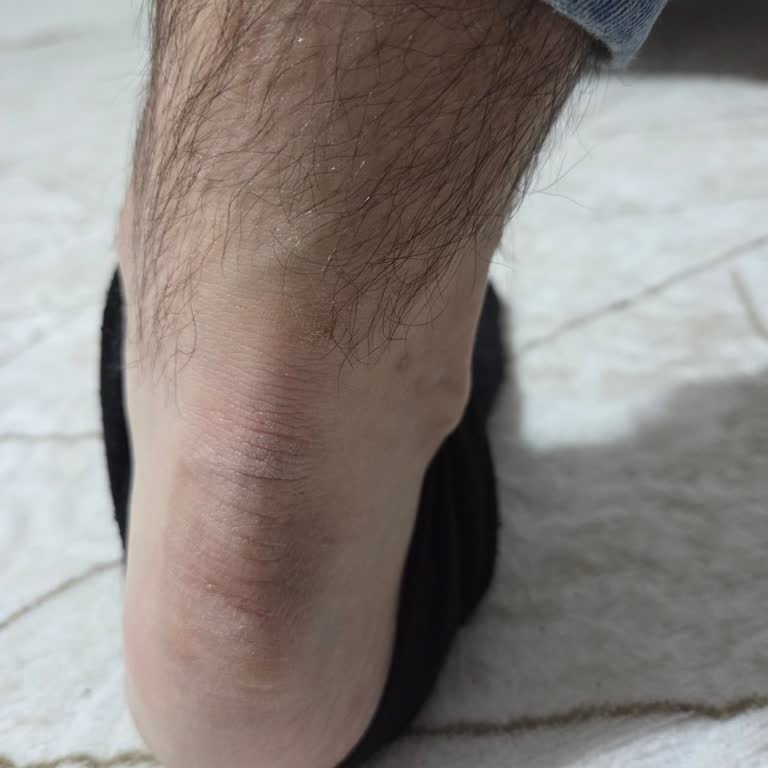 Sağlığıma Zarar Veren Dockers Ayakkabı Ve Eksik İnceleme Raporu