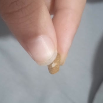 Trendyol'da Bozulmuş Kedi Maması Ve Cevapsız Müşteri Hizmetleri