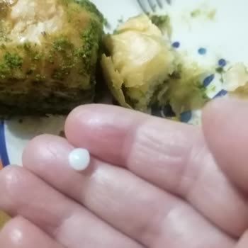 Baklava İçindeki Plastik Parça Dişimi Kırdı, Şikayetime Cevap Gelmedi