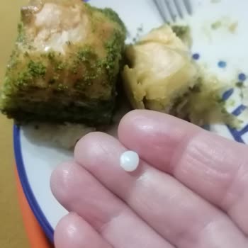 Baklava İçindeki Plastik Parça Dişimi Kırdı, Şikayetime Cevap Gelmedi