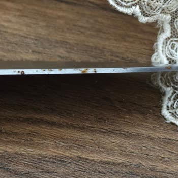 Paslanan Bıçak Seti İçin Hijyen Endişesi Ve Değişim İsteği