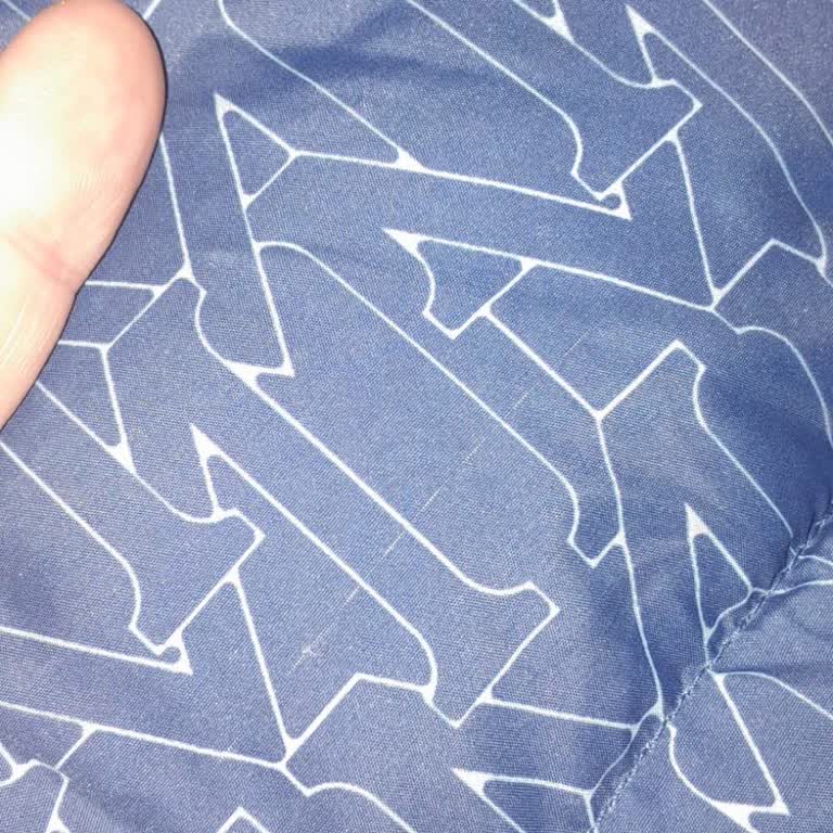 Mavi Montta Kısa Sürede Kol Sökülmesi Ve Mağaza Çalışanlarının Kırıcı Davranışı