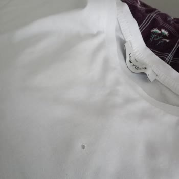 Siemens Çamaşır Makinesinde Tekrarlayan Yırtma Sorunu Ve Servis İhmali