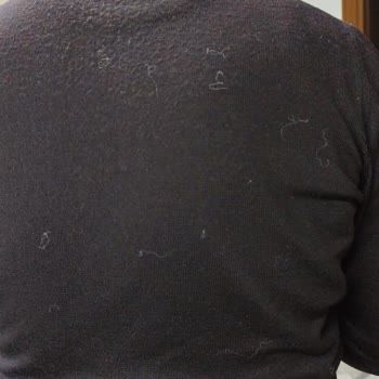 Kabanım Tüy Dökmeye Başladı, Mağazadan Cevap Yok