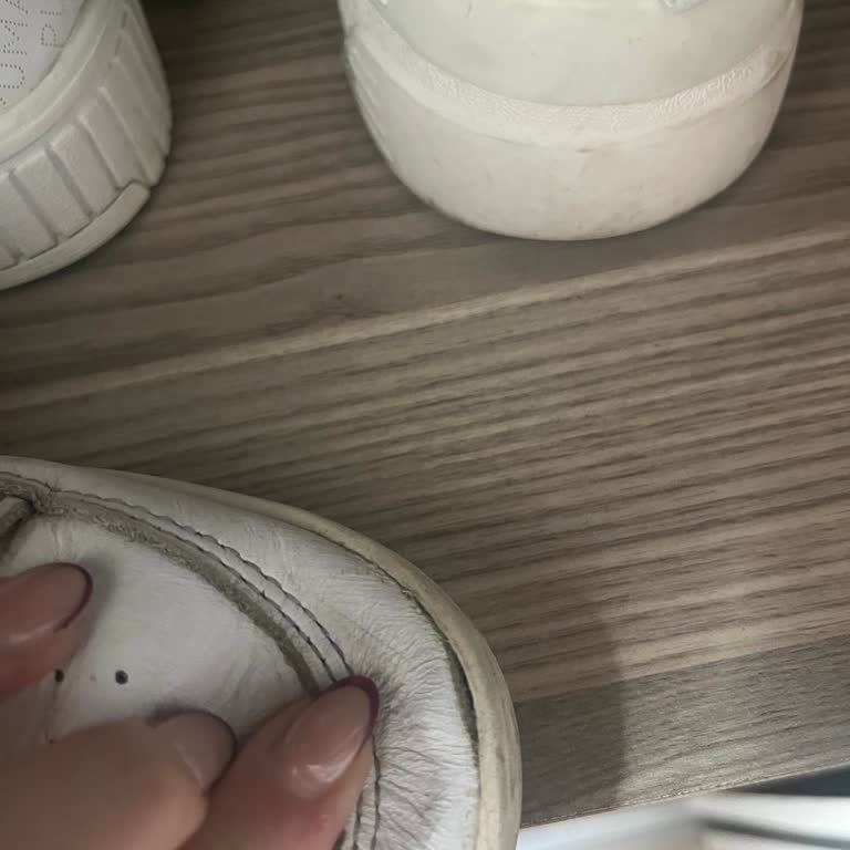 Ayakkabıda 9 Ayda Deformasyon Ve Açılma Değişim Veya İade İsteği