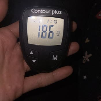 Sibionics Türkiye Sensörün Gösterdiği Şeker Değerleriyle Parmak Ölçümleri Arasında Ciddi Farklar Var