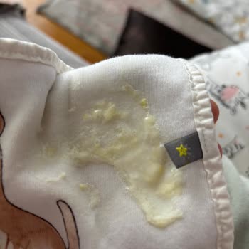 Hipp Combiotic 1 Numaralı Devam Sütünde Renk Farkı Bebeğimde Kusma Ve Karın Ağrısına Neden Oldu