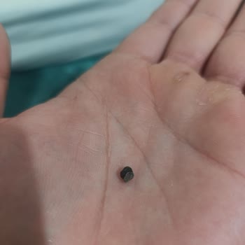 Eti Gıda Mini Kraker İçinde Demir Parçası: Sağlık Ve Güven Tehlikesi