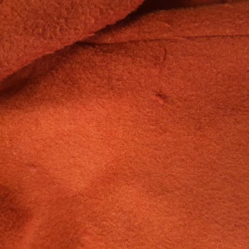 Kabanım Üç Kez Giyildikten Sonra Tüylendi, H&M Ayıplı Ürün İadesini Reddetti