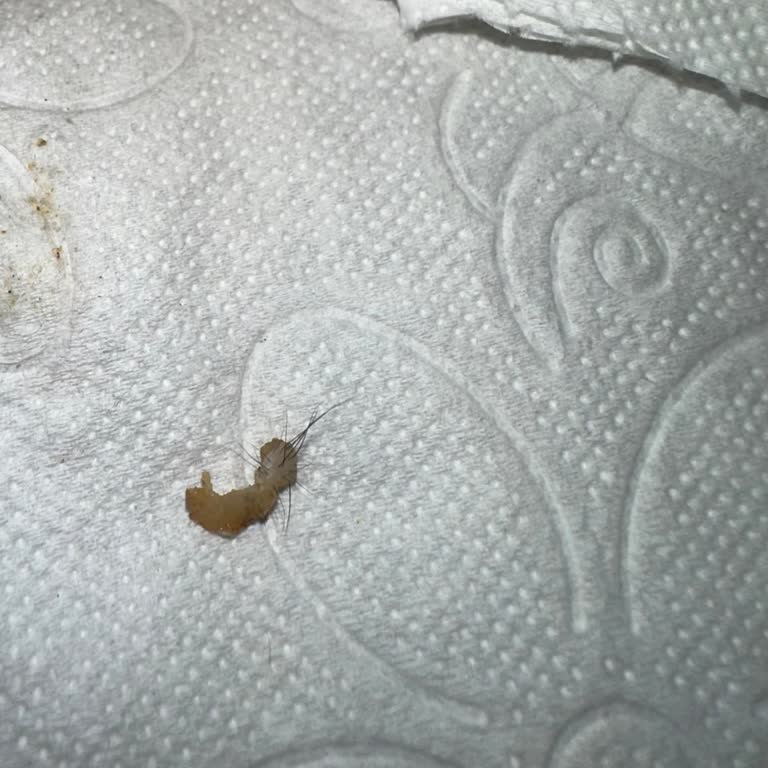 Hijyen Sorunu: Lahmacun İçinde Kıllı Deri Parçası