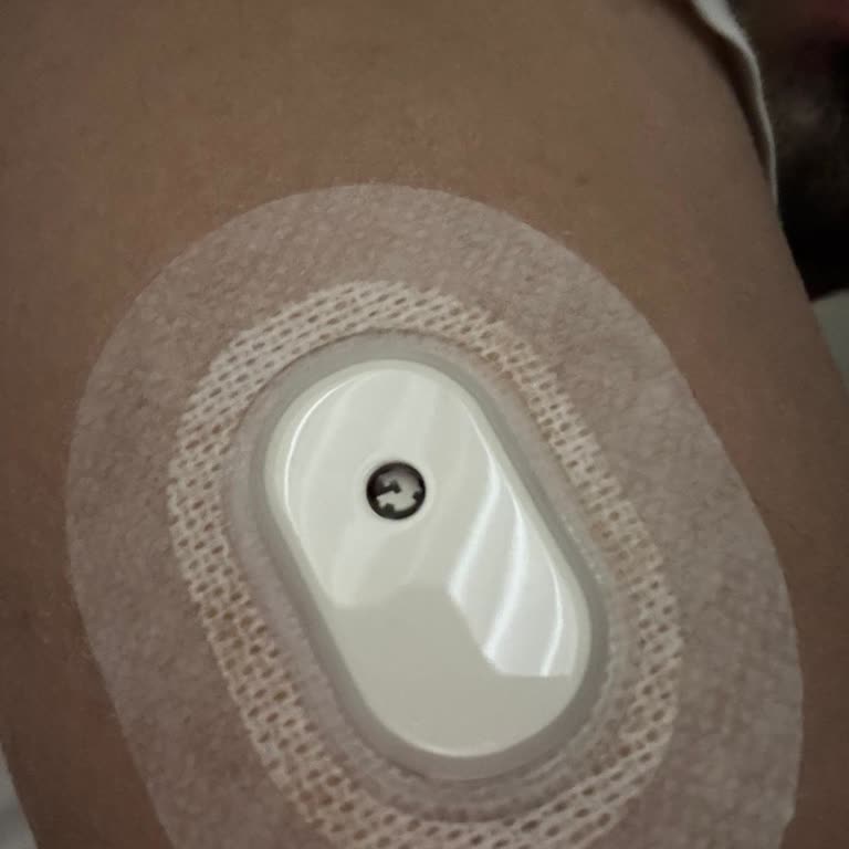 Sibionics Türkiye GS1 Üründe Sıkıntı Yaşıyorum