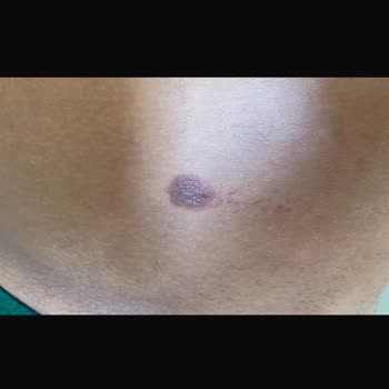 Esse Nova Güzellik (İzmir) Lazer Epilasyon İçin Gittim Ve Hiç Memnun Kalmadım