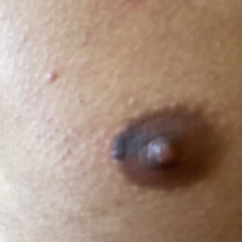 Esse Nova Güzellik (İzmir) Lazer Epilasyon İçin Gittim Ve Hiç Memnun Kalmadım