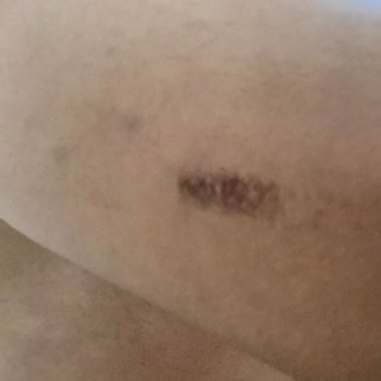 Esse Nova Güzellik (İzmir) Lazer Epilasyon İçin Gittim Ve Hiç Memnun Kalmadım