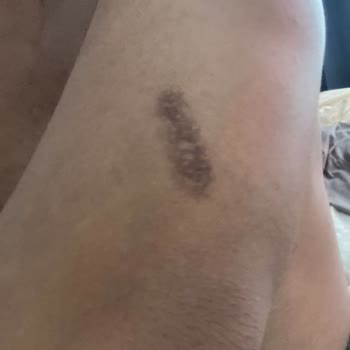 Esse Nova Güzellik (İzmir) Lazer Epilasyon İçin Gittim Ve Hiç Memnun Kalmadım