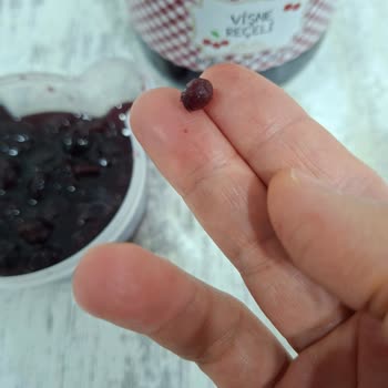 BİM Vişne Reçelindeki Çekirdek Dişimi Kırdı, Tedavi Masraflarımın Karşılanmasını İstiyorum