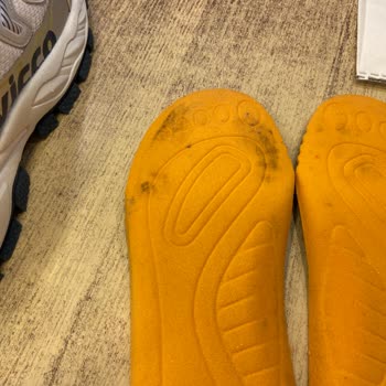 Vicco Ayakkabısında Küf Oluşumu Ve Mantar Enfeksiyonu