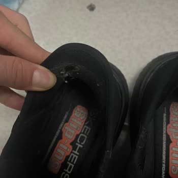 Ayakkabının Arka Kısmının Topuğu Vurması Ve Değişim Talebi