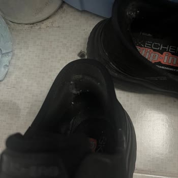 Ayakkabının Arka Kısmının Topuğu Vurması Ve Değişim Talebi