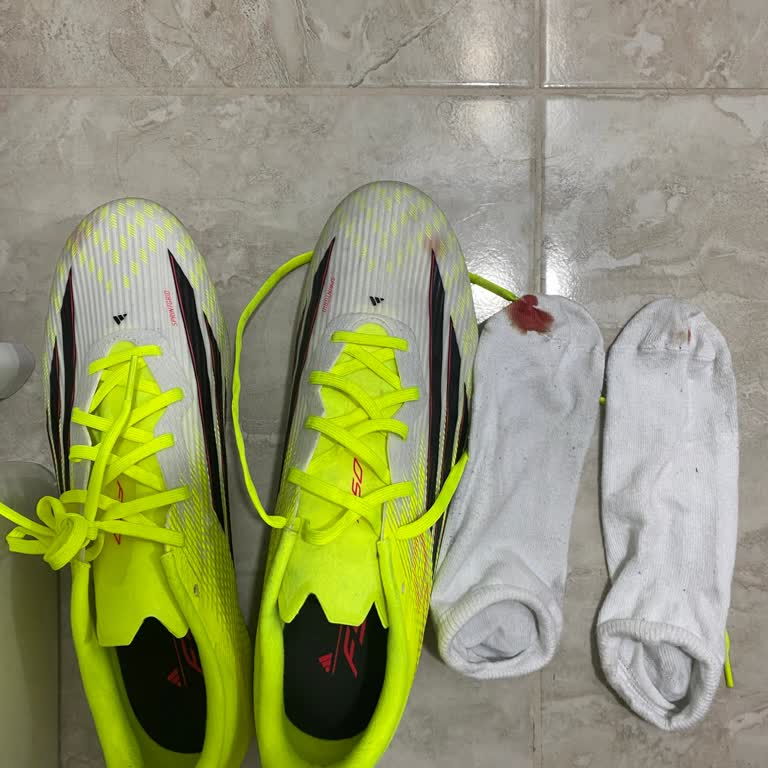 Intersport Ayak Yaralanmasına Neden Olan Kramponun İadesi Reddedildi