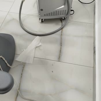 Lazer Epilasyon Sonuçları Yetersiz, Seans Süresi Kısa Ve Hijyen Eksikliği