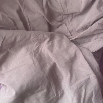 Yanlış Renk Çarşaf Ve Eksik Taşıma Çantası Cevapsızlığı