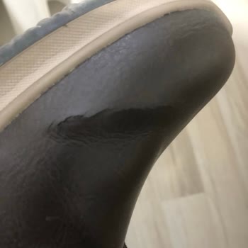 Skechers Ayakkabının Kısa Sürede Çatlaması Ve Boyner’in Kullanıcı Hatası İddiası