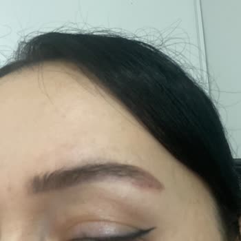 Kalıcı Kaş İşleminde Yara Ve Kanama, 2800 TL İadesi Talebi