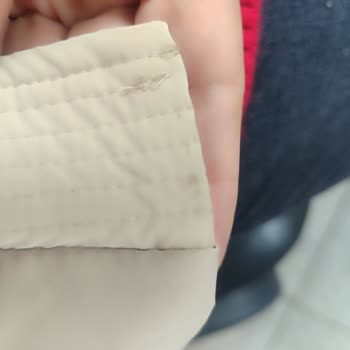 Dikiş Hatalı Mont İçin Garanti Reddi Ve Destek Eksikliği