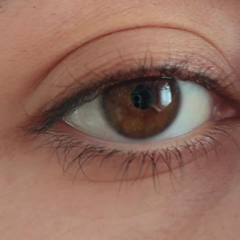 Dermavise Güzellik Merkezleri Yapılan İşlem Soyuldu