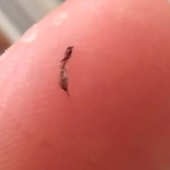 Dermavise Güzellik Merkezleri Yapılan İşlem Soyuldu