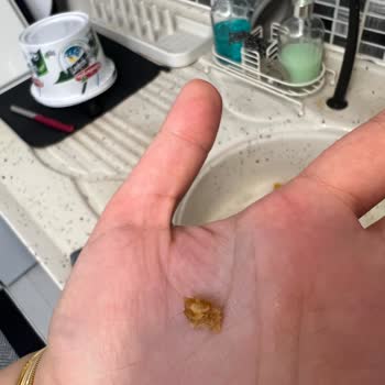 Lezita Kovasındaki Kıl İçeriği Beni Rahatsız Etti Ve İade Talebim